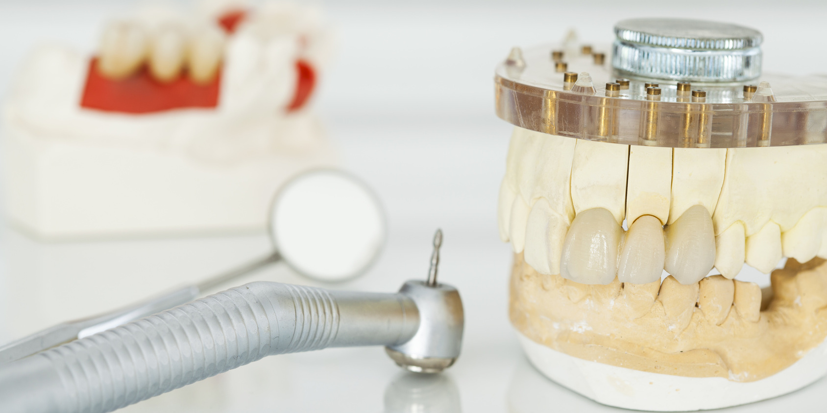 Metal free ceramic dental crowns
